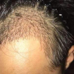 发际线分享社区