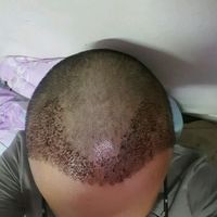 發(fā)際線用戶圖片