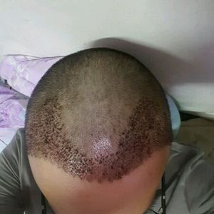 发际线分享社区
