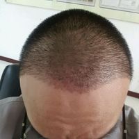 發(fā)際線用戶圖片