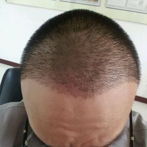发际线分享社区