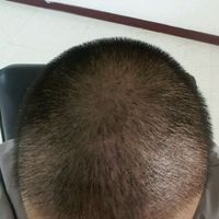 發(fā)際線用戶圖片
