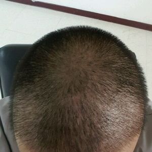 发际线分享社区