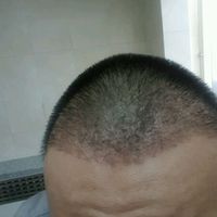 發(fā)際線用戶圖片