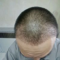 發(fā)際線用戶圖片