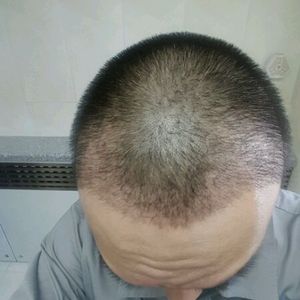 发际线分享社区