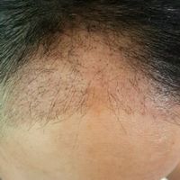 發(fā)際線用戶圖片