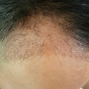 发际线分享社区