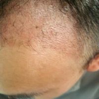 發(fā)際線用戶圖片