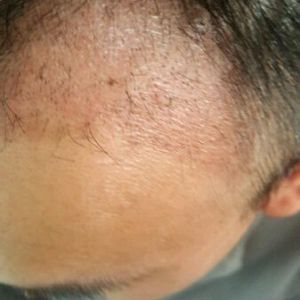 发际线分享社区