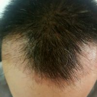 發(fā)際線用戶圖片