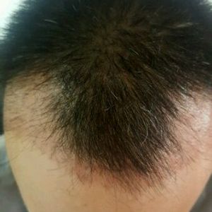 发际线分享社区