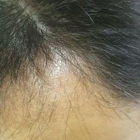 發(fā)際線用戶圖片