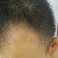 發(fā)際線用戶圖片