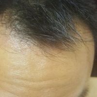 發(fā)際線用戶圖片