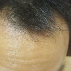 发际线分享社区