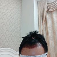 發(fā)際線用戶圖片