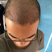 發(fā)際線用戶圖片
