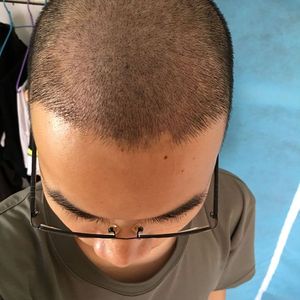 发际线分享社区