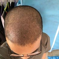 發(fā)際線用戶圖片