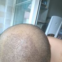 禿頂用戶圖片