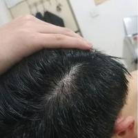 發(fā)際線用戶圖片