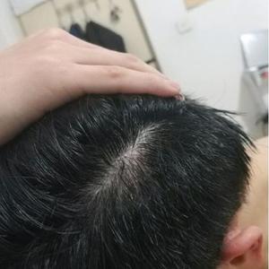 发际线分享社区