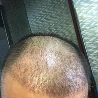 發(fā)際線用戶圖片