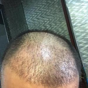 发际线分享社区