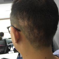 發(fā)際線用戶圖片