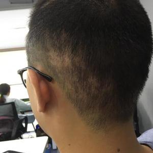 发际线分享社区