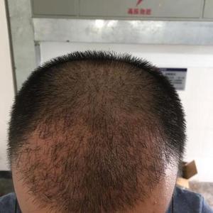 发际线分享社区