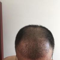 發(fā)際線用戶圖片