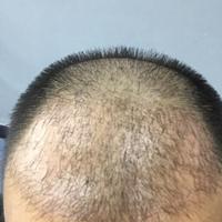 發(fā)際線用戶圖片