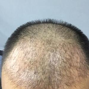 发际线分享社区