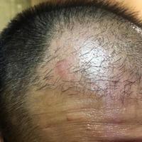 發(fā)際線用戶圖片