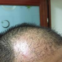 發(fā)際線用戶圖片