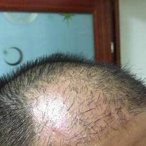 发际线分享社区