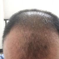 發(fā)際線用戶圖片
