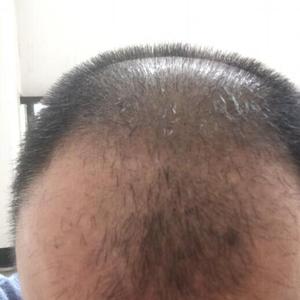 发际线分享社区