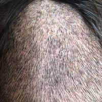 發(fā)際線用戶圖片
