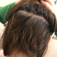 發(fā)際線用戶圖片