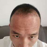 發(fā)際線用戶圖片
