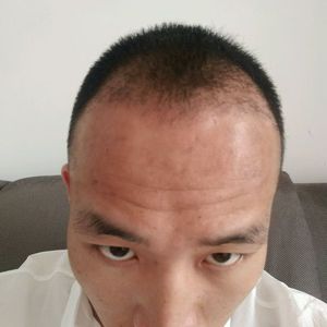 发际线分享社区