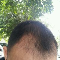 發(fā)際線用戶圖片