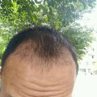 發(fā)際線用戶圖片