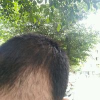 發(fā)際線用戶圖片