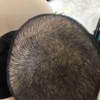 發(fā)際線用戶圖片