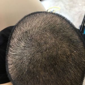 发际线分享社区