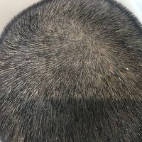 發(fā)際線用戶圖片